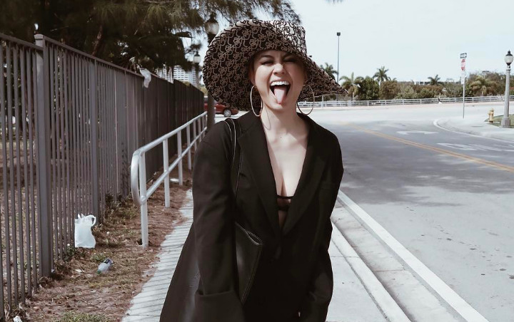 Berjemur di Pantai, Agnes Monica Dipuji Lebih Cantik Tanpa Make Up Meski Wajah Bintik-bintik