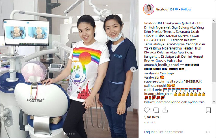 Tina Toon Endorse Perawatan Gigi