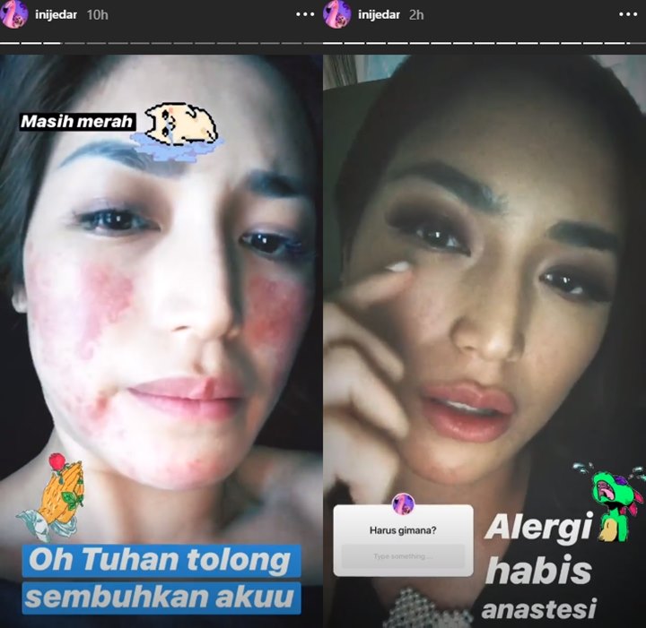 InstagStory Jedar