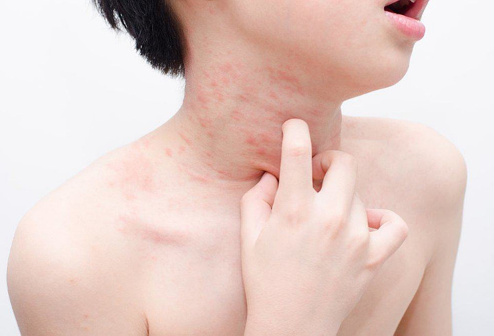 Memelihara Hewan Justru Bisa Mencegah Alergi Loh