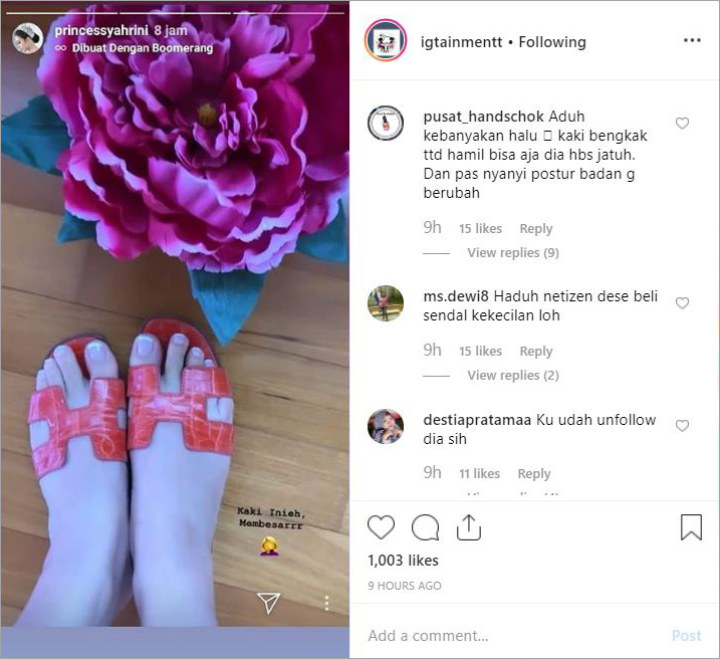 Syahrini Kaki Bengkak
