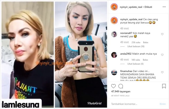 Barbie Kumalasari Pamer Lesung Pipi Baru Tiru Rosa Meldianti Diledek Makin Aneh
