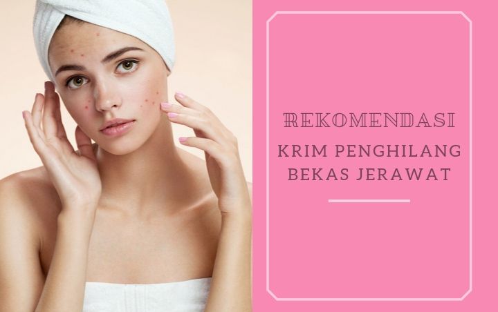 Dijual dengan Harga Terjangkau, Ini 8 Krim Penghilang Bekas Jerawat yang Berkualitas Baik