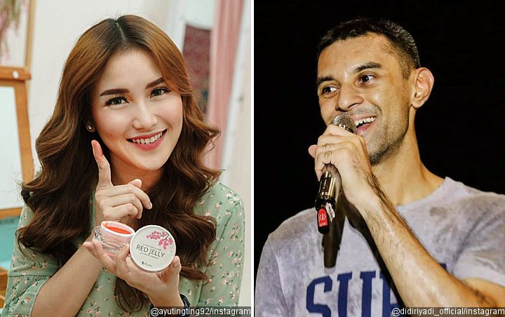 Ayu Ting Ting Tunjukkan Pelipis Benjol, Didi Riyadi Beri Perhatian Manis Bikin Baper