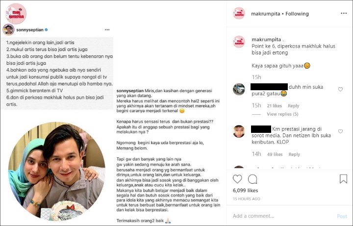 Sonny Septian Prihatin Banyak Artis Bikin Sensasi Untuk Tempuh Jalan Pintas Jadi Terkenal