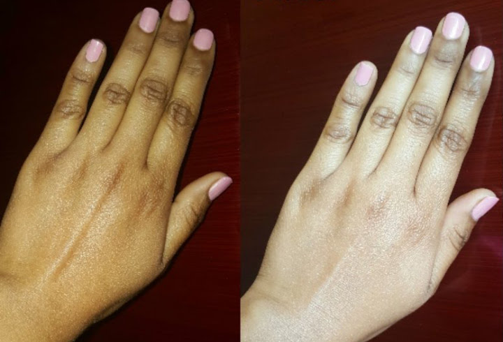 Sudah Pasti Bahwa Body Lotion Bermanfaat Untuk Mencerahkan Kulit