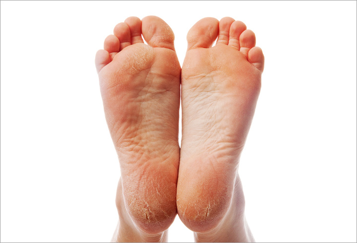 Ada Bagian Kulit Yang Kasar? Tak Perlu Khawatir Body Lotion Bisa Melembutkannya
