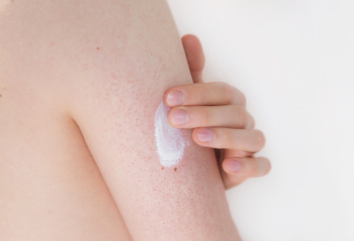 Body Lotion Juga Bisa Menjadi Pelindung Kulit Dari Iritasi