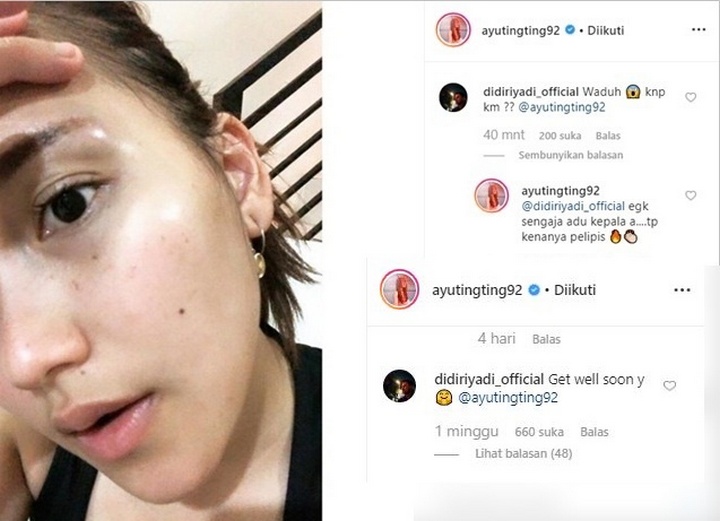 Perhatian Didi Riyadi Buat Ayu Ting Ting Langsung Meleleh