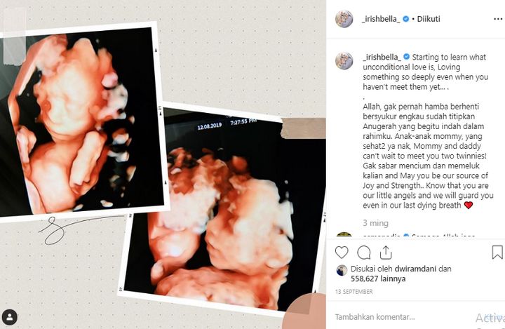 Ungkapan Cinta Irish Bella ke Putri Kembar