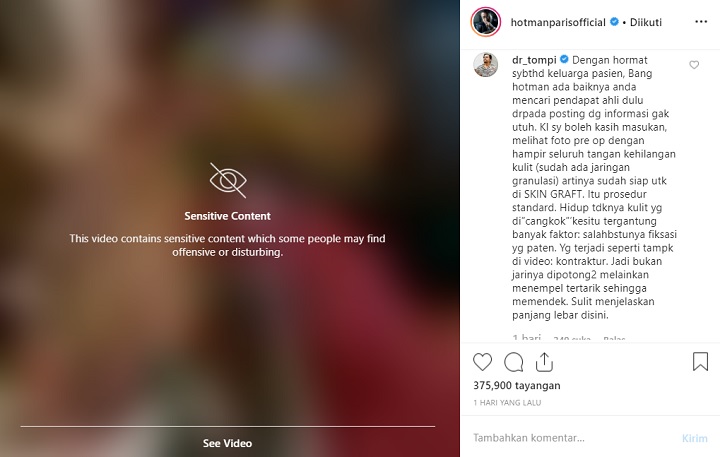 Komentar Tompi pada Hotman Paris