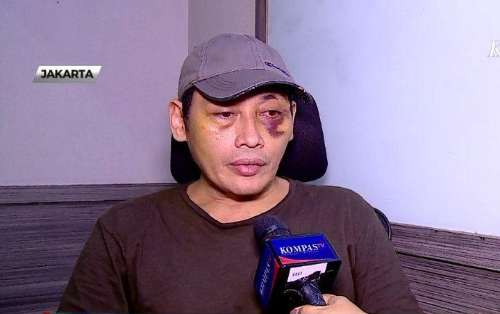 Tersangka Penyekapan Ninoy Karundeng Ungkap Sosok 'Habib' Dalam Kasusnya