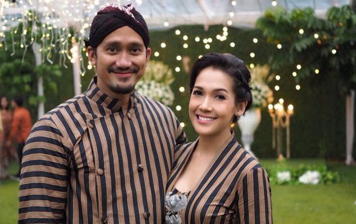  Korban Make Up, Wajah Mieke Amalia Bengkak Tak Bisa Dikenali Bikin Tora Sudiro Syok