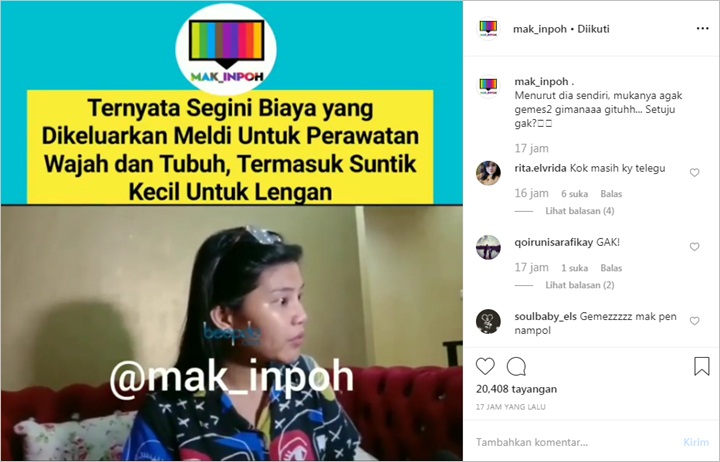 Penjelasan Rosa Meldianti Soal Biaya Fantastis Untuk Perawatan Tuai Reaksi Tak Terduga