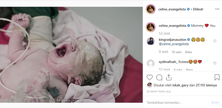 Celine Akhirnya Pamer Bayi
