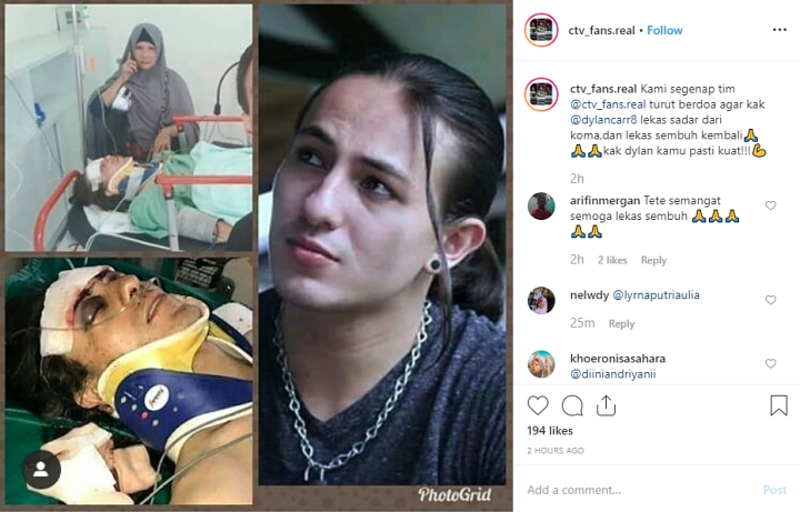 Wajah Lebam Dylan Carr