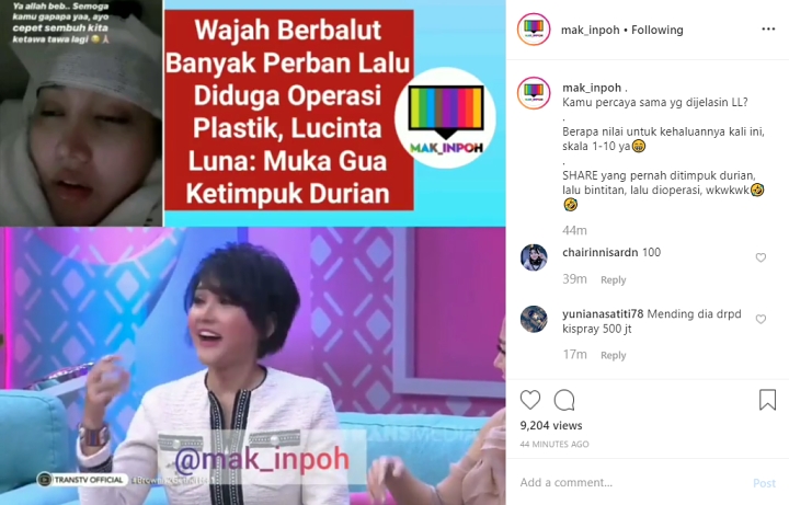 Lucinta Luna Operasi Kelopak Mata Usai Ketimpuk Durian, Sebut Kepala