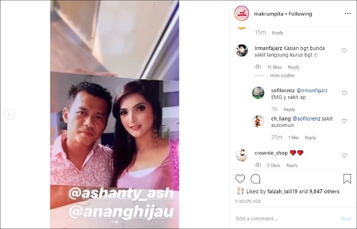 Sakit Autoimun, Aurel Hermansyah Tunjukkan Potret Lawas Ashanty 9 Tahun Lalu Bikin Haru