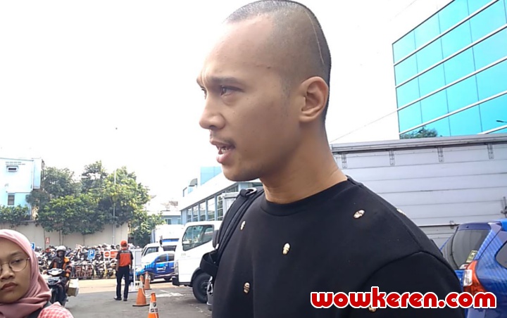 Bima Aryo Ungkap Penyebab Kematian Anjing Peliharaan Yang Gigit