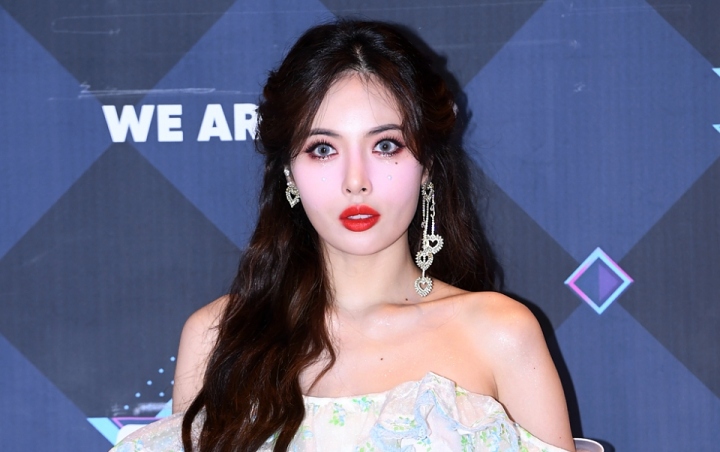 HyunA Terbukti Dilarang Banyak Bicara Dikala Jadi Bintang Tetamu Running Man, Mengapa? HyunA Terbukti Dilarang Banyak Bicara Dikala Jadi Bintang Tetamu Running Man, Mengapa?