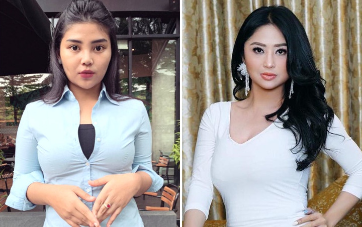 Begini Tanggapan Rosa Meldianti Soal Diledek Dewi Persik