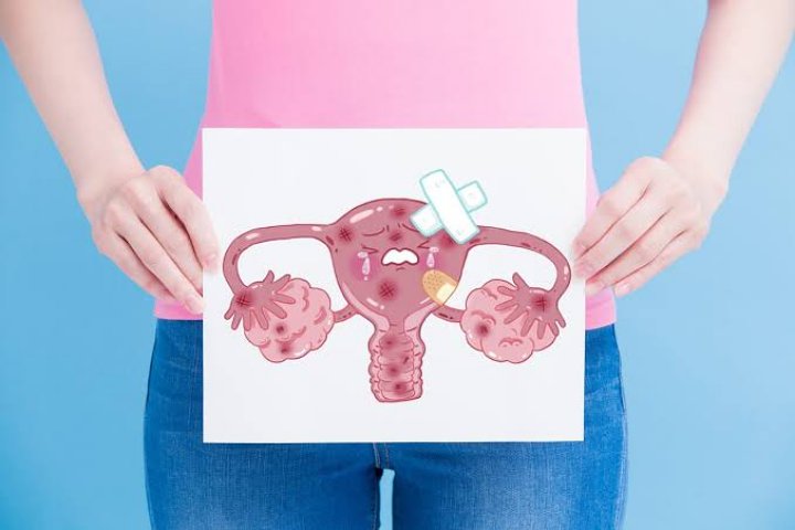 Waspadai, Diet Yoyo Bisa Meningkatkan Resiko Kanker Endometriosis