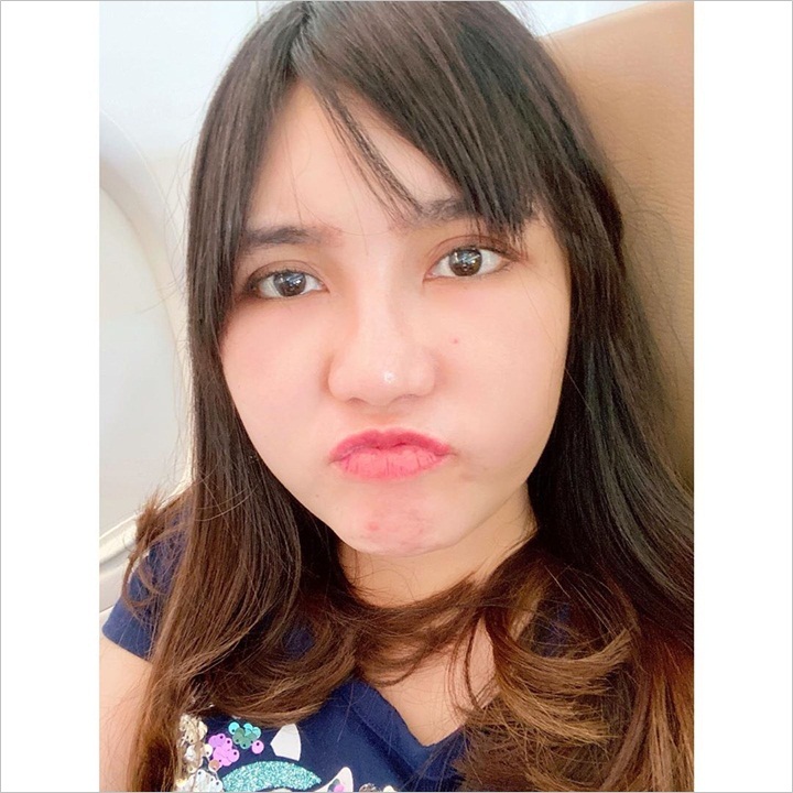 Kalau Gini, Wajah Bengkaknya Gak Keliahatan Yah Guys