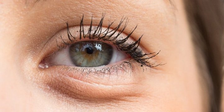 Jengkel dengan Kantung Mata yang Besar? Tenang, Atasi Itu dengan Masker Putih Telur