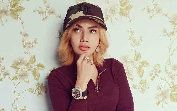 Niat Percantik Diri, Bentuk Filler Bibir Barbie Kumalasari Malah Bikin Syok Dinilai Menyeramkan