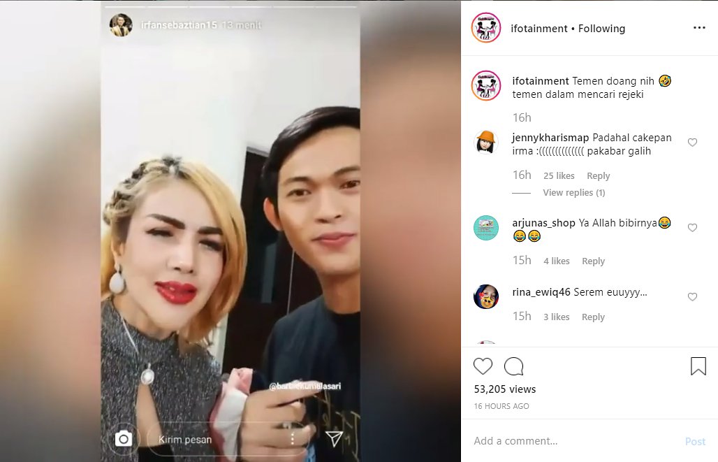 Bibir Mirip Joker, Barbie Kumalasari Masih Percaya Diri Dekati Irfan Sbaztian?