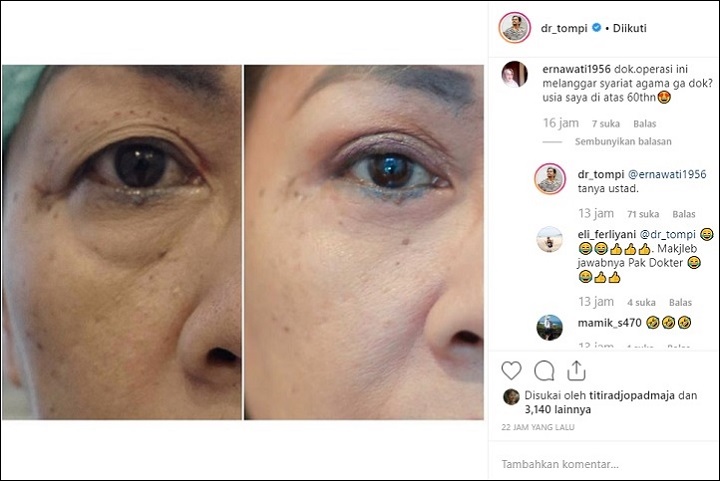 Jawaban Simple Tompi Saat Ditanya Apakah Operasi Wajah Melanggar Syariat Agama