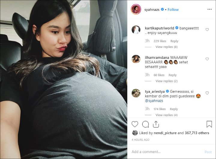 Hamil Anak Kembar, Syahnaz Sadiqah Pamer Perut Besar Mirip Balon Bikin Rekan Artis Heran