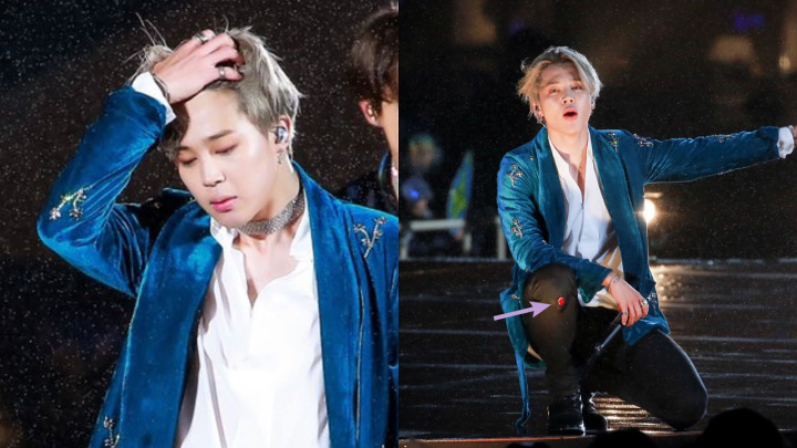 Jimin BTS Dipuji Tetap Santuy Meski Lututnya Terluka Hingga Berdarah di Panggung