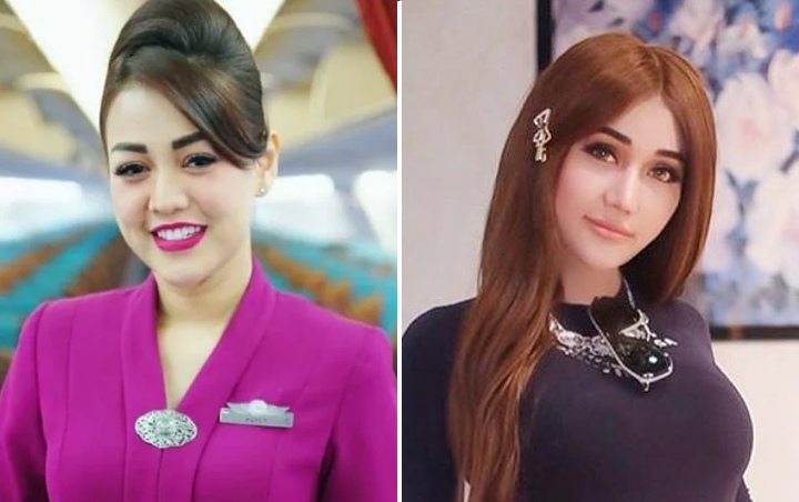 Puteri Novita Kalah Cantik dari Lucinta Luna, Harga Oplas di Jepang dan London Super Mahal?