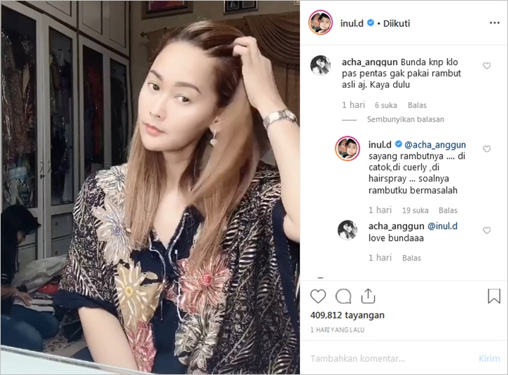 Inul Daratista Hobi Pakai Rambut Palsu Saat Tampil di Berbagai Acara, Ternyata Ini Alasan Kerennya