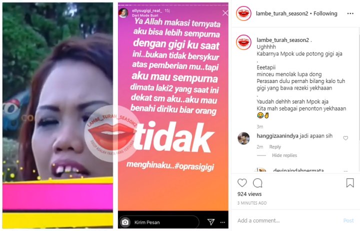 Ely Sugigi Operasi Gigi Demi Kekasih Baru, Video Lawas Ini Kembali Disorot