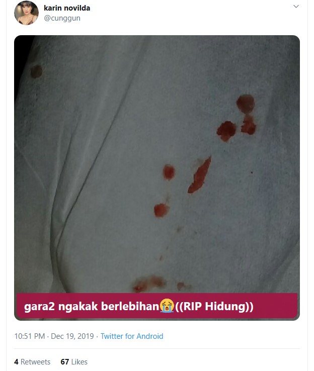 Awkarin Tertawa Sampai Hidung Berdarah Gara-Gara Ketiban HP