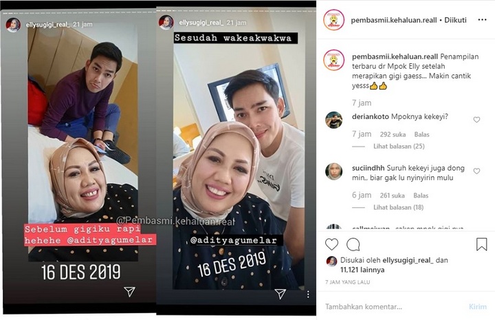 Ely Sugigi Dipuji Makin Cantik Setelah Rapikan Gigi Hingga Terima Julukan Baru