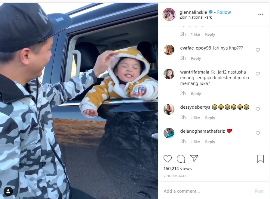 Glenn Alinskie ‘Lempar’ Natusha Ke Jendela Mobil, Jari-Jari Penuh Plester Jadi Sorotan