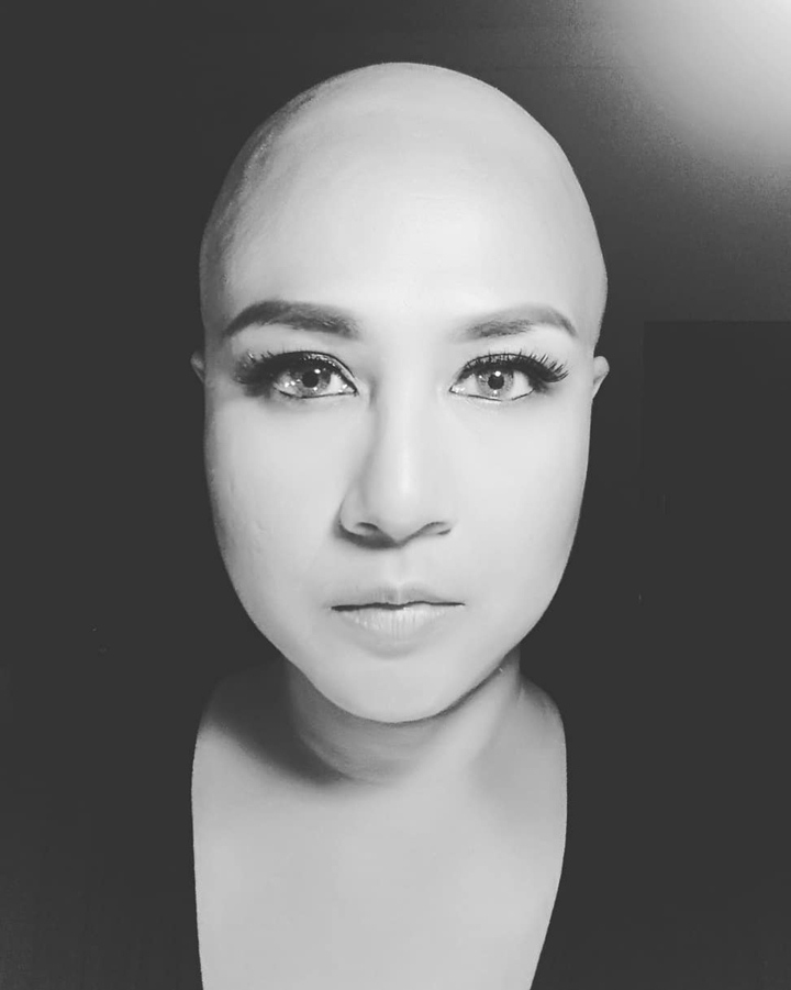 Ria Irawan Pede Tampil Dengan Kepala Plontos Usai Jalani Perawatan Kanker