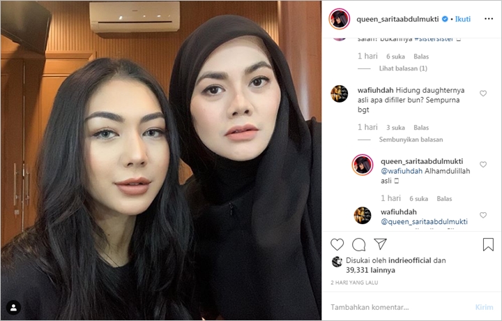 Keaslian Hidung Putri Sulung Diragukan, Reaksi Sarita Abdul Mukti Bikin Adem