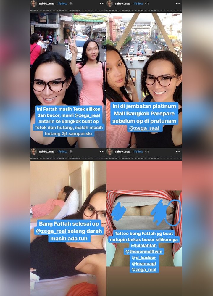 Gebby Vesta Bongkar Potret Lawas Lucinta Luna Saat Lakukan Operasi Payudara Masih Hutang Rp 2 Juta
