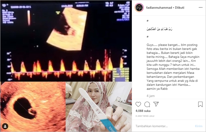 Fadlan Muhammad Akhirnya Buka Suara Soal Isu Pisah dengan Lyra Virna
