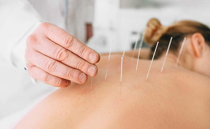 Rutin Melakukan Terapi Akupunktur Bisa Jadi Solusi Yang Sering Hiperventilasi