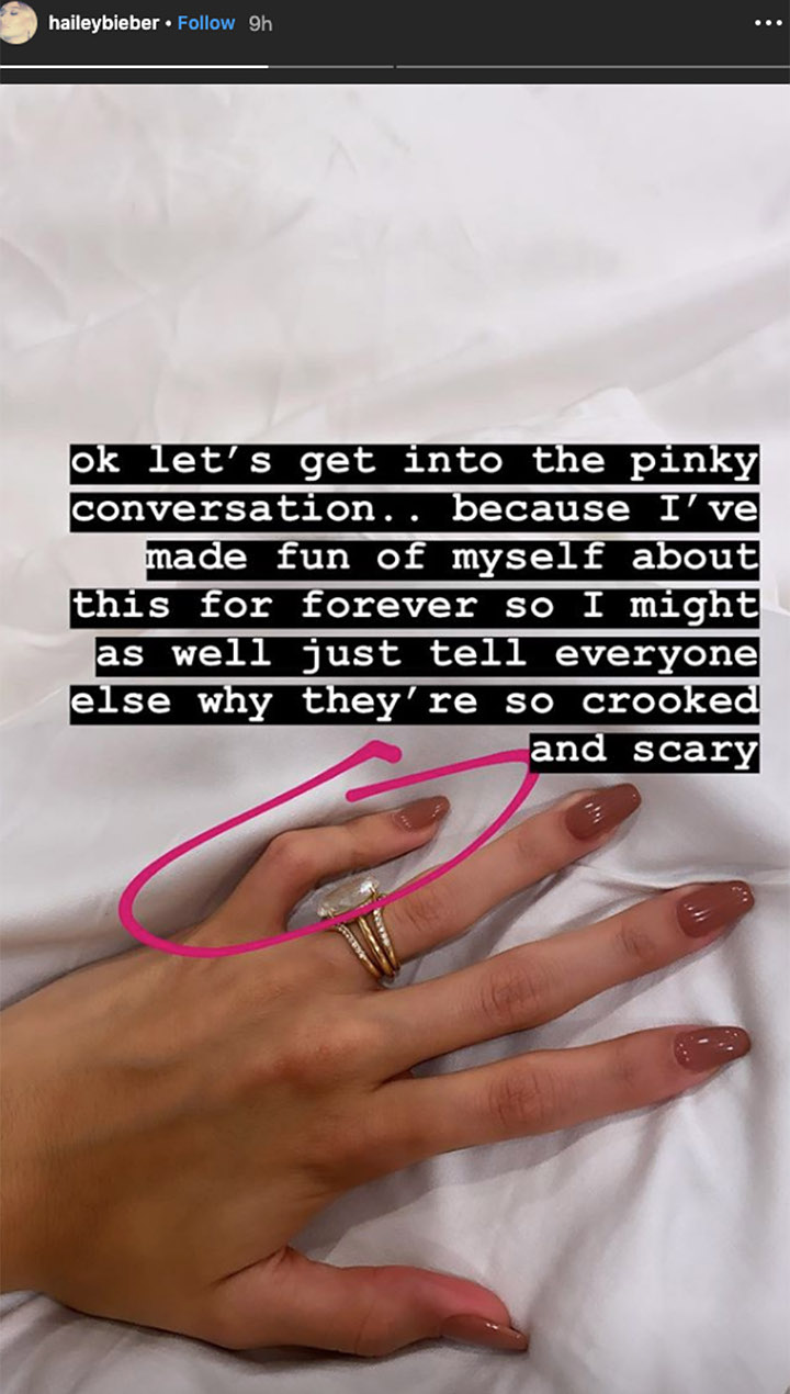Bikin Kaget, Bagian Tubuh Hailey Baldwin Ini Ternyata CacatBikin Kaget, Bagian Tubuh Hailey Baldwin Ini Ternyata Cacat
