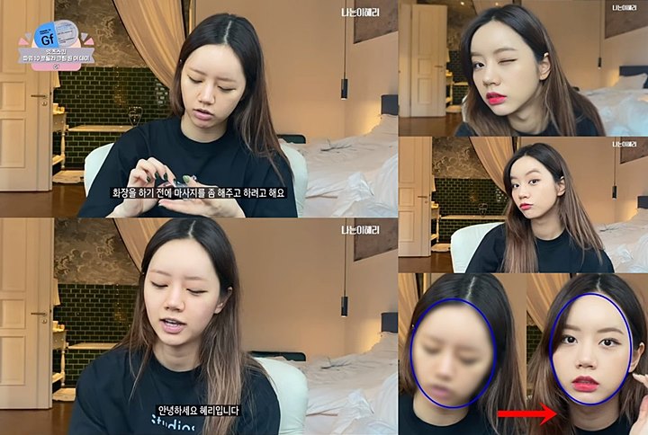 Hyeri Pamer Wajah Tanpa Makeup, Implan Dahi Sampai Jakun di Leher Jadi Sorotan