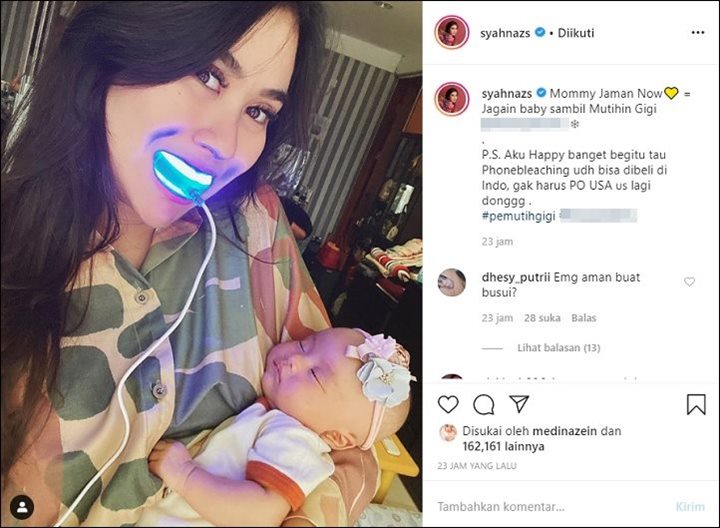 Syahnaz Sadiqah Mutihin Gigi Sambil Gendong Bayi Bikin Khawatir