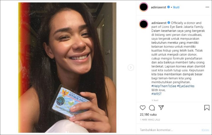 Jadi Duta \'Help Them To See\', Adinia Wirasti Daftarkan Diri Jadi Calon Pendonor Kornea