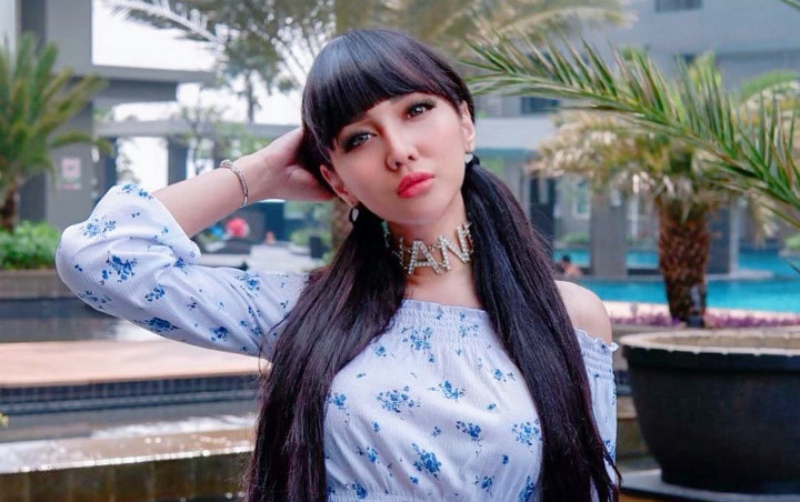 Kondisi Terkini Lucinta Luna Disebutkan Alami Pembengkakan Di Tubuh