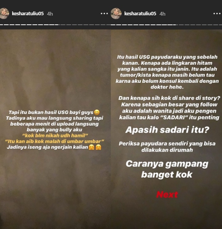 Kesha Ratuliu Bagikan Foto USG Padahal Belum Menikah